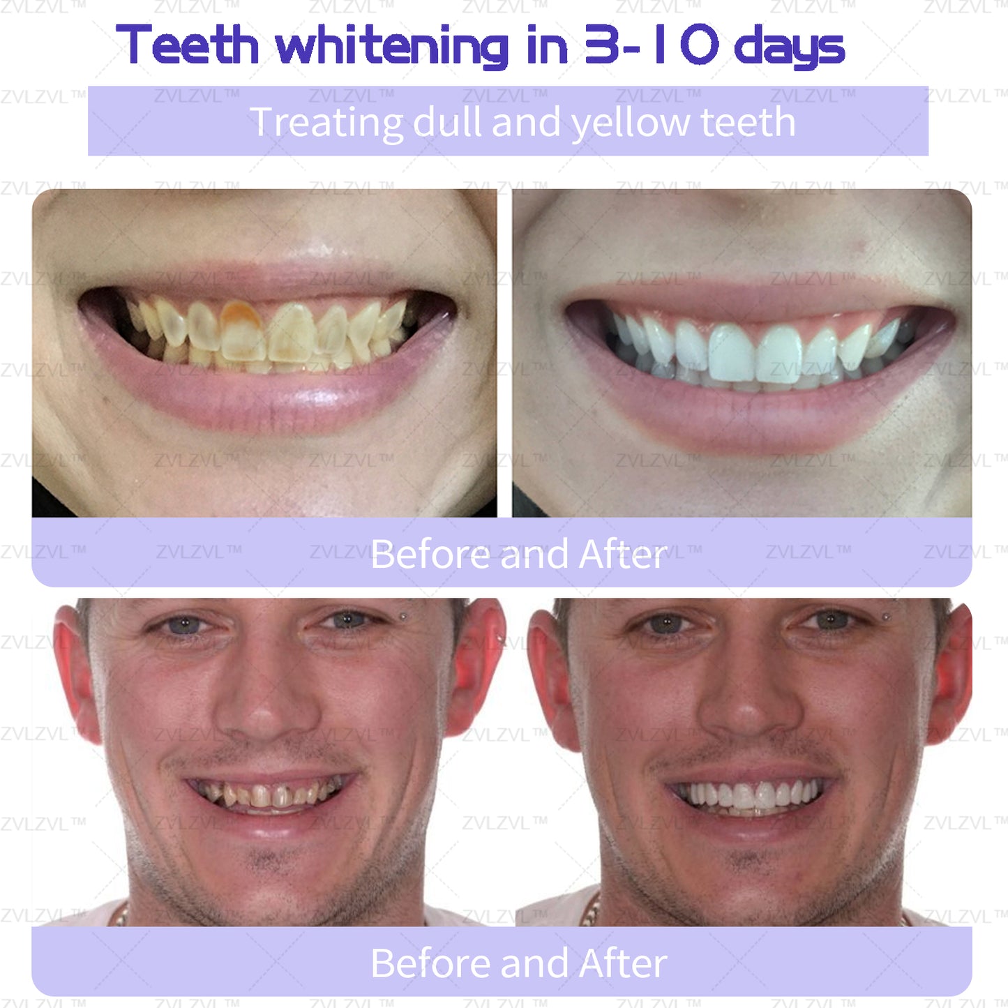 ZVLZVL™🔥🔥 ⏰ Limited time exclusive offer! Only this time, enjoy 70% OFF! This is a privilege that only you can enjoy! Hurry up and order ZVLZVL™ Tooth Powder to restore a healthy smile, don’t miss it!