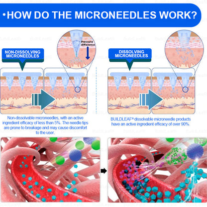 🏥Official Store | BuildLeaf® SMGT-GLP-1 Nano Microneedle Patch with Collagen & Matrixyl 3000 丨Obesity,Cardiovascular Diseas, Diabetes, Sleep Apnea, Joint Problems and More
